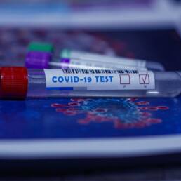 L'esito (positivo) di un test per il COVID19