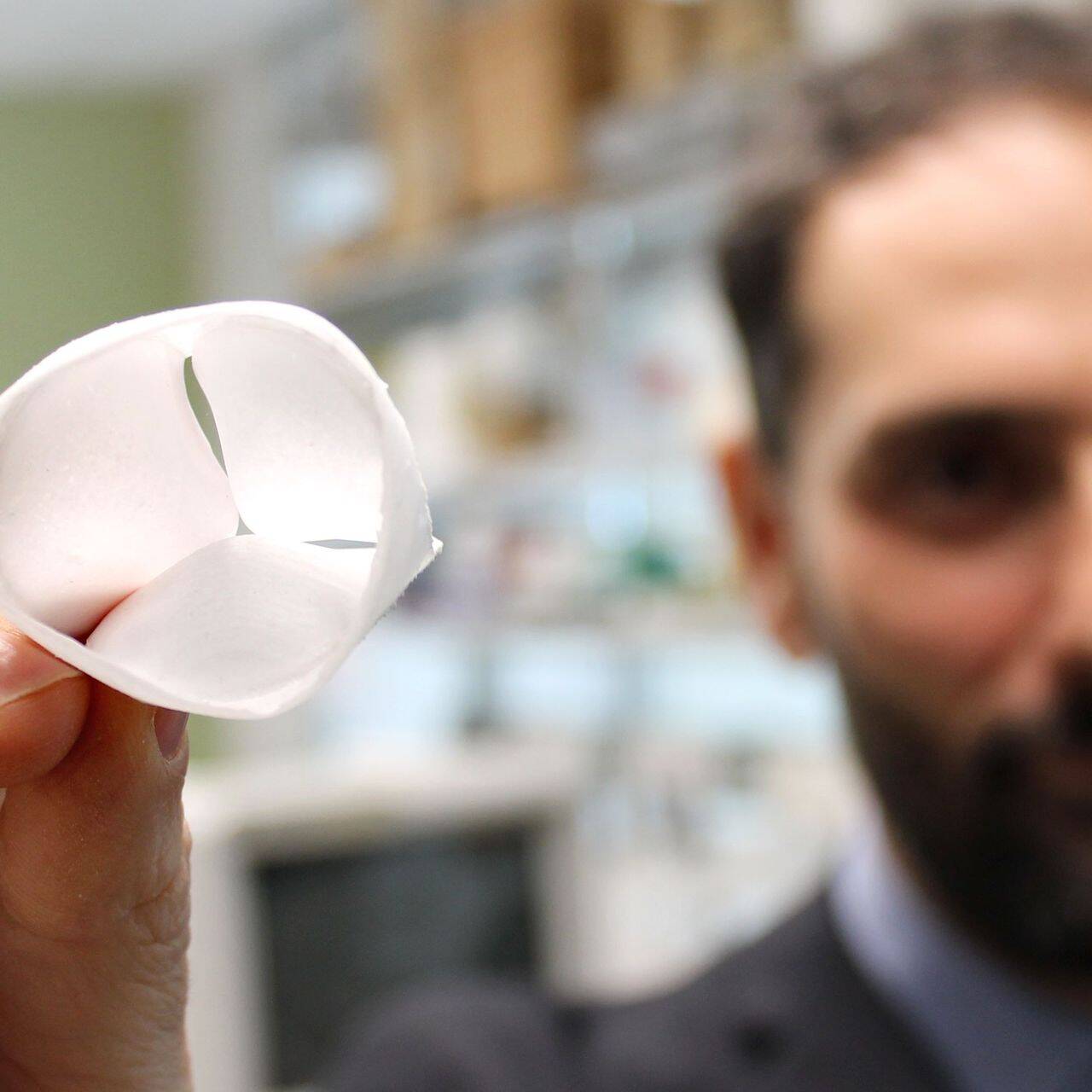 Il dottor Antonio D'Amore con la valvola cardiaca biomimetica