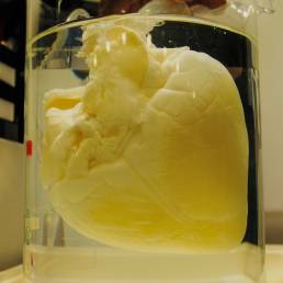 Cuore decellularizzato realizzato da Lifelab-Coris Veneto