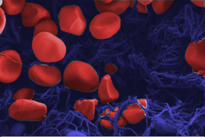 In the center of a blood clot With the scanning electron microscope, red blood cells with a diameter of just a few micrometers can be clearly visualized. © Empa