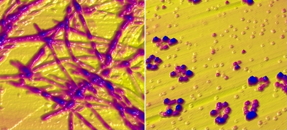 Le immagini scattate con il microscopio a forza atomica mostrano l'alfa-sinucleina sotto forma di fibrille (a sinistra). Se la proteina viene posta in una soluzione contenente rame, si formano invece strutture a forma di anello (a destra). © EMPA